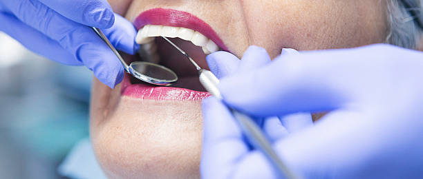 Best Knocked-Out Tooth (Avulsed Tooth) Treatment in Laurel Springs, NJ